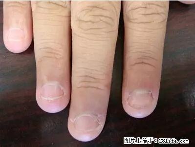 剪指甲、挖耳屎，这些日常小动作竟隐藏大危害！ - 辽源生活资讯 - 辽源28生活网 liaoyuan.28life.net
